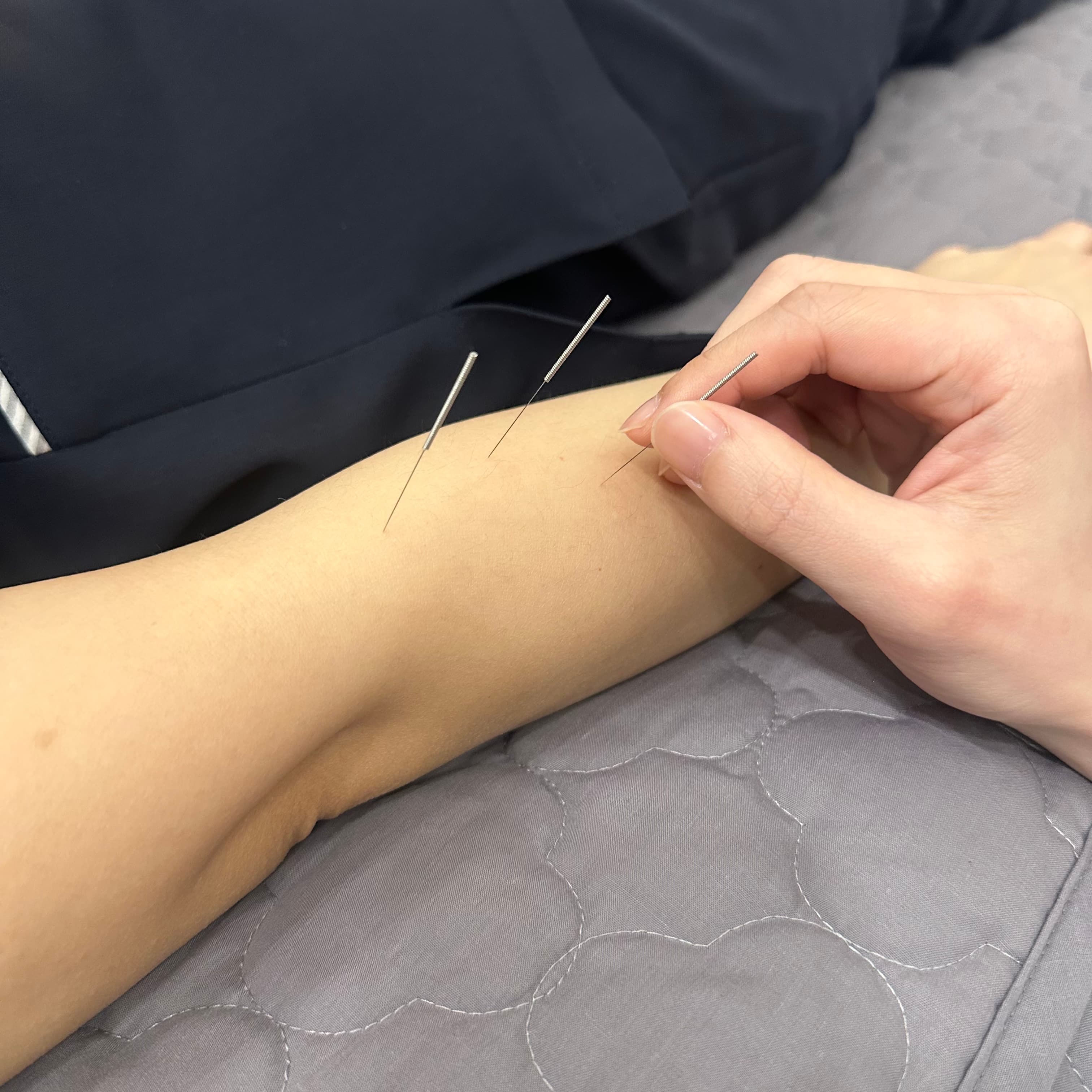 아프지 않은 치료